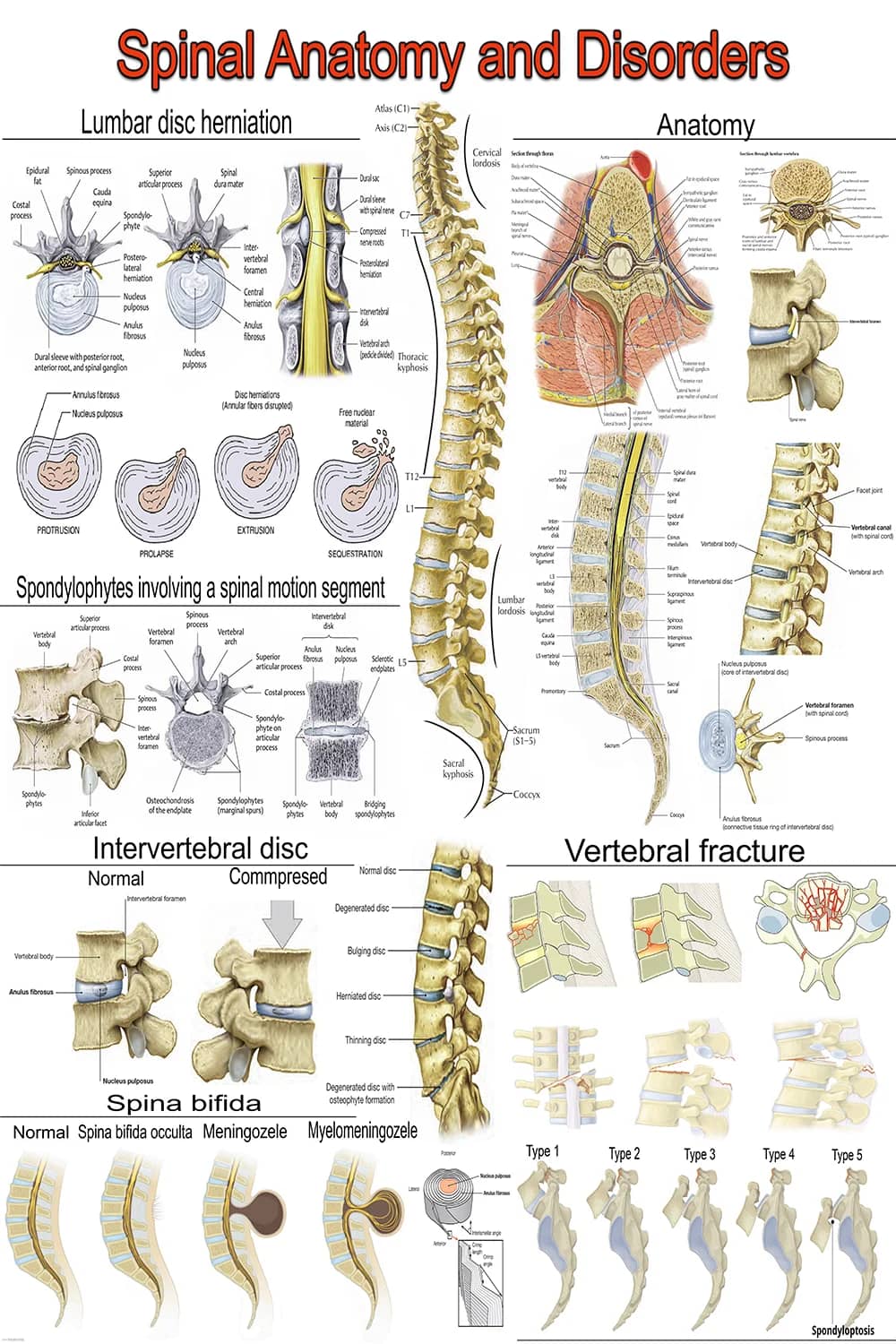 Vista principal del cartel anatГіmico de anatomГa y trastornos de la columna vertebral.